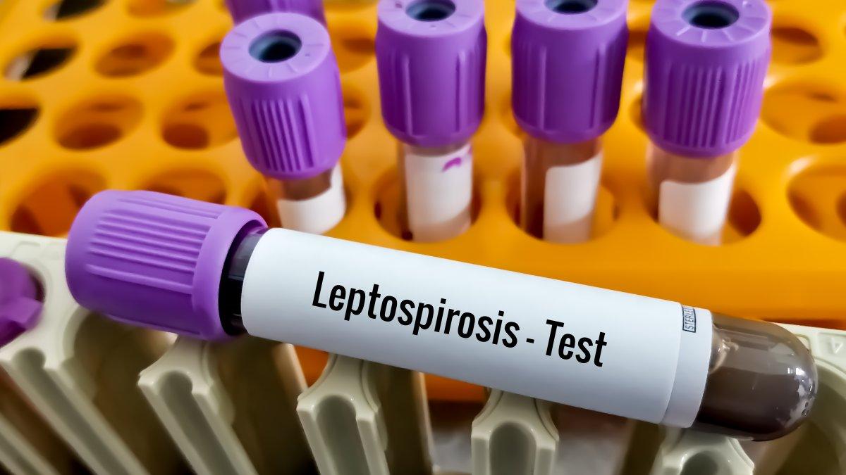 Death's leptospirosis dies because Chicago issued health announcements - NBC Chicago