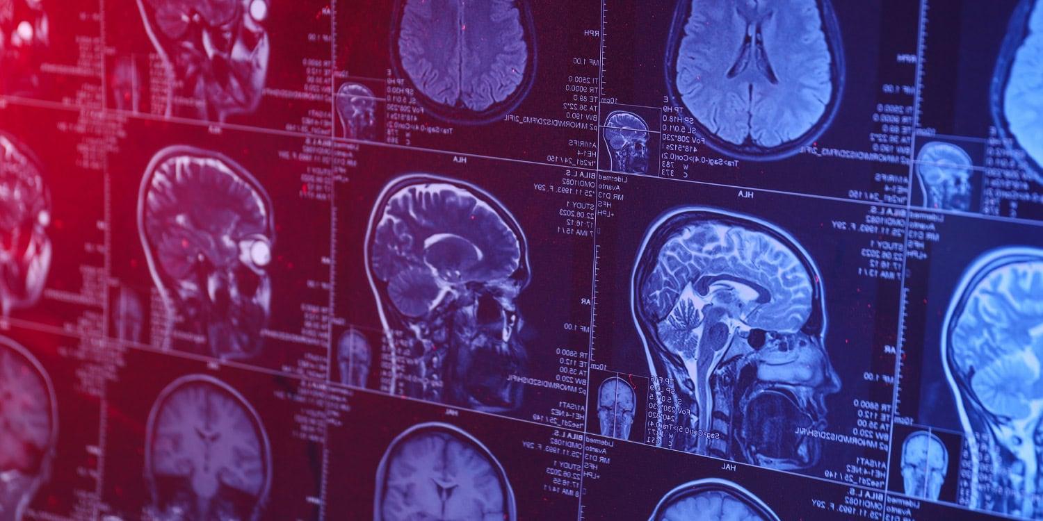 Anxiety disorders associated with low levels of key nutrients